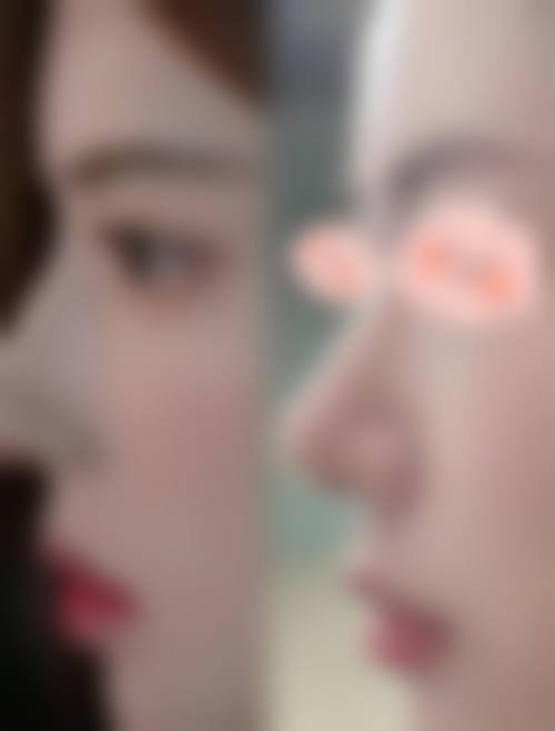 二、厦门素色曾云医疗美容诊所怎么样？