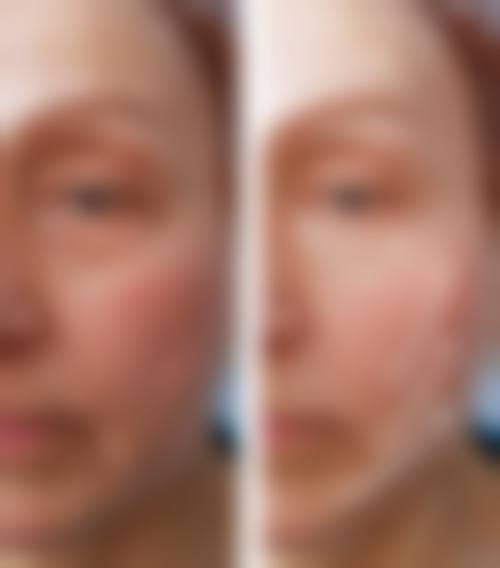 四、肇庆柏悦医疗美容门诊部特色项目