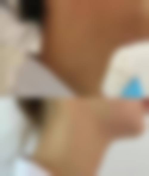 六、湖南附大皮肤病门诊部地址及交通