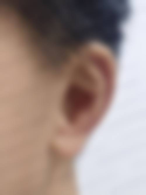 四、上虞亚韩医疗美容美容诊所特色项目