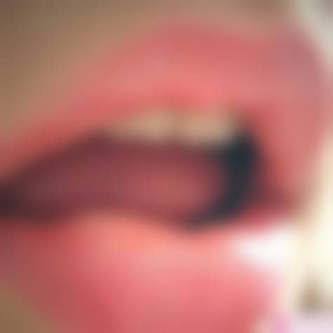 四、杭州艾缇医疗美容门诊部特色项目