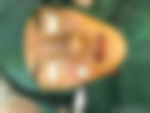 六、慈溪悦尔医学美容机构价格表