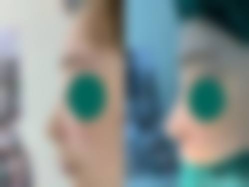 九、韩国三星line整形外科真实的患者评价