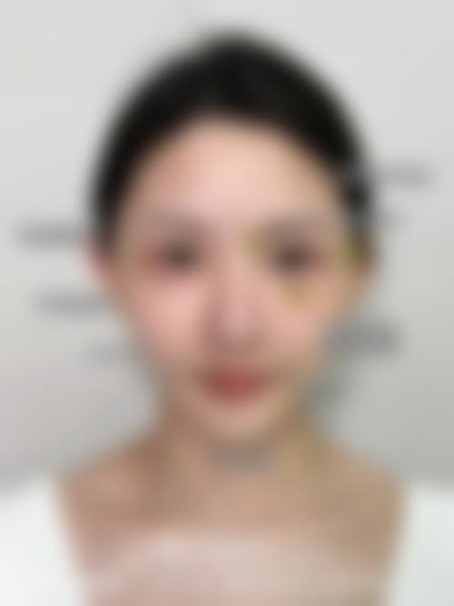 六、韩国三星line整形外科价格表