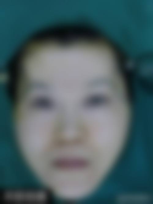 八、湖南附大皮肤病门诊部真实的患者评价