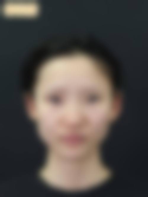 三、湖南附大皮肤病门诊部诊疗项目有哪些？