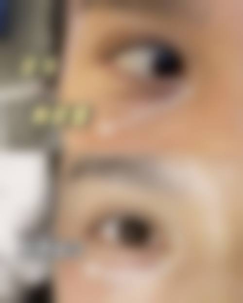 八、上虞亚韩医疗美容美容诊所真实的患者评价