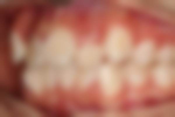 二、湖南附大皮肤病门诊部怎么样？