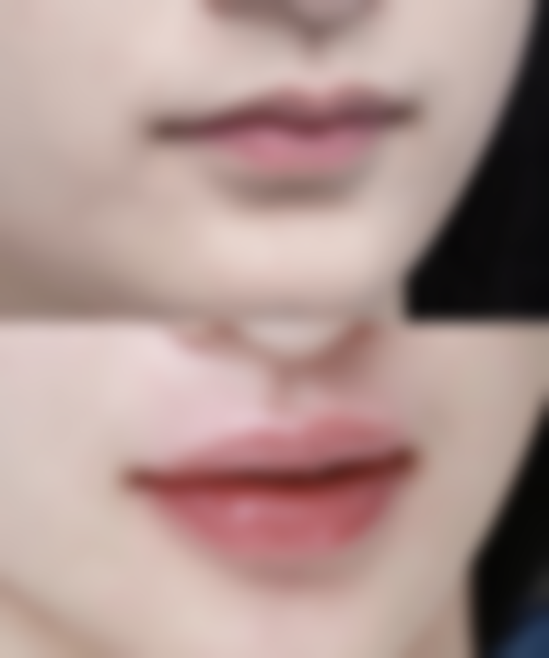 七、上虞亚韩医疗美容美容诊所预约方式