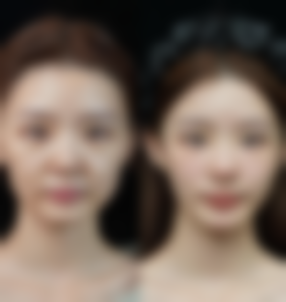 一、眼袋突然黑了怎么回事:常见原因分析