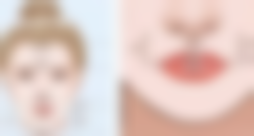 不是疤痕体质疤痕会慢慢消除吗？深度解析疤痕消退规律与加速淡化方法 