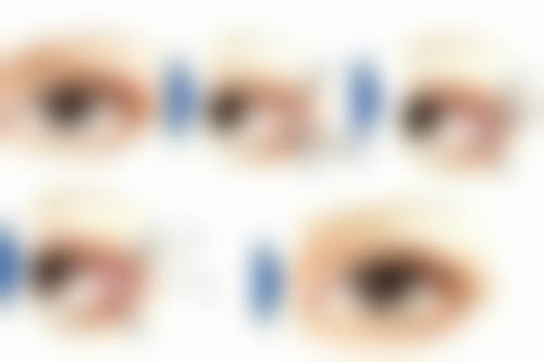 三、日常护理须知