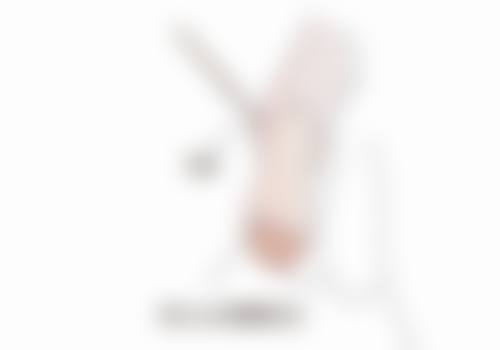 三、不是疤痕体质如何加速疤痕淡化