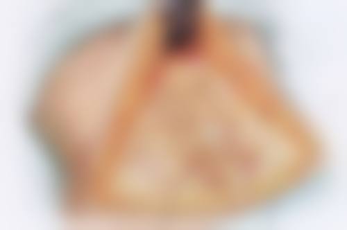 一、不是疤痕体质疤痕消退的基本规律