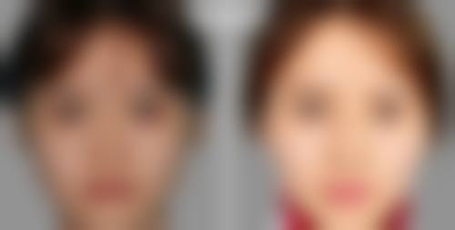 五、南宁梦想整形医院价格表