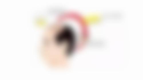 六、深圳碧莲盛无痕植发价格表