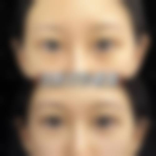 五、杭州一佳医疗美容门诊价格表