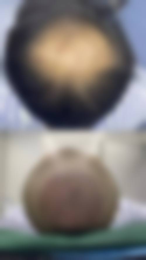 三、重庆春草世纪植发医院诊疗项目有哪些？