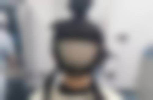 九、深圳碧莲盛无痕植发真实的患者评价