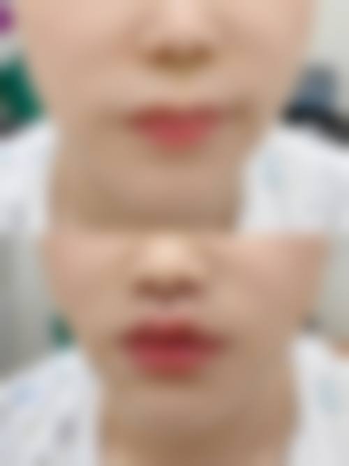 九、营口暨大科源医疗美容诊所真实的患者评价