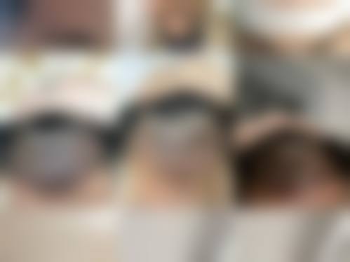 四、重庆春草世纪植发医院特色项目