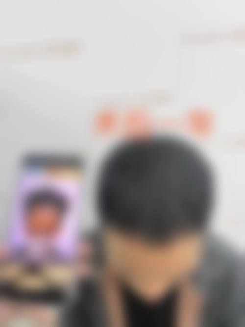 四、深圳碧莲盛无痕植发特色项目