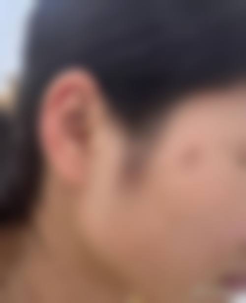 四、广州加美拉医疗美容诊所特色项目