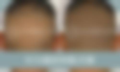 七、南宁梦想整形医院预约方式