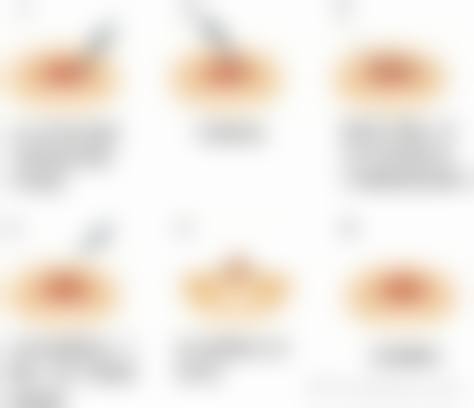 四、note整形外科特色项目