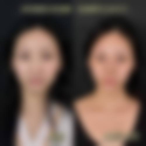 五、厦门长庚医院 - 整形美容医院价格表