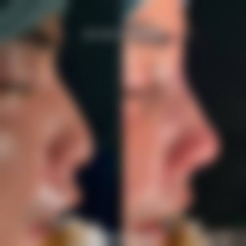 八、厦门长庚医院 - 整形美容医院真实的患者评价