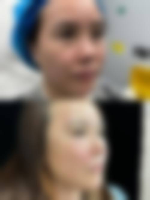 八、忻州维多利亚整形美容医院真实的患者评价