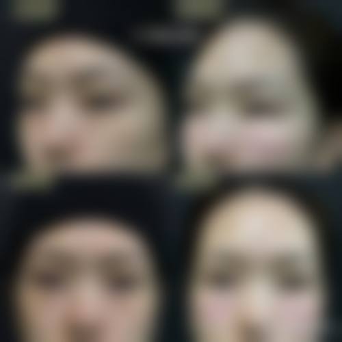 五、南通仟美医疗美容诊所价格表