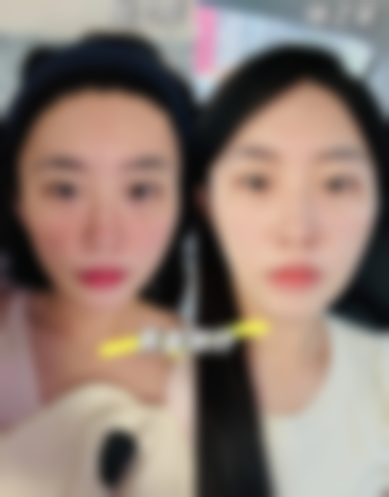 四、抽脂减肥后多久可以安心运动