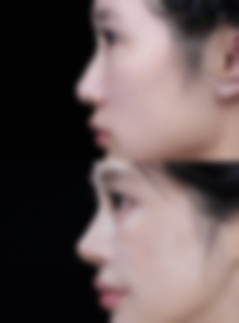 七、韩国OYOUNG整形外科预约方式