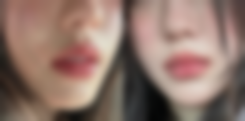 八、韩国OYOUNG整形外科真实的患者评价