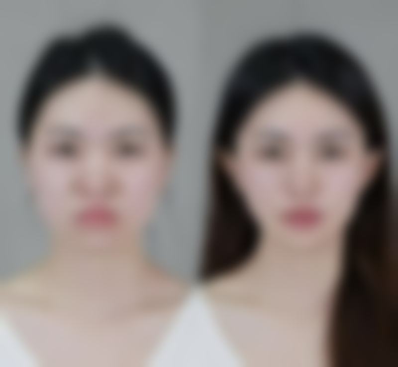 五、襄阳辰美医疗美容门诊部价格表