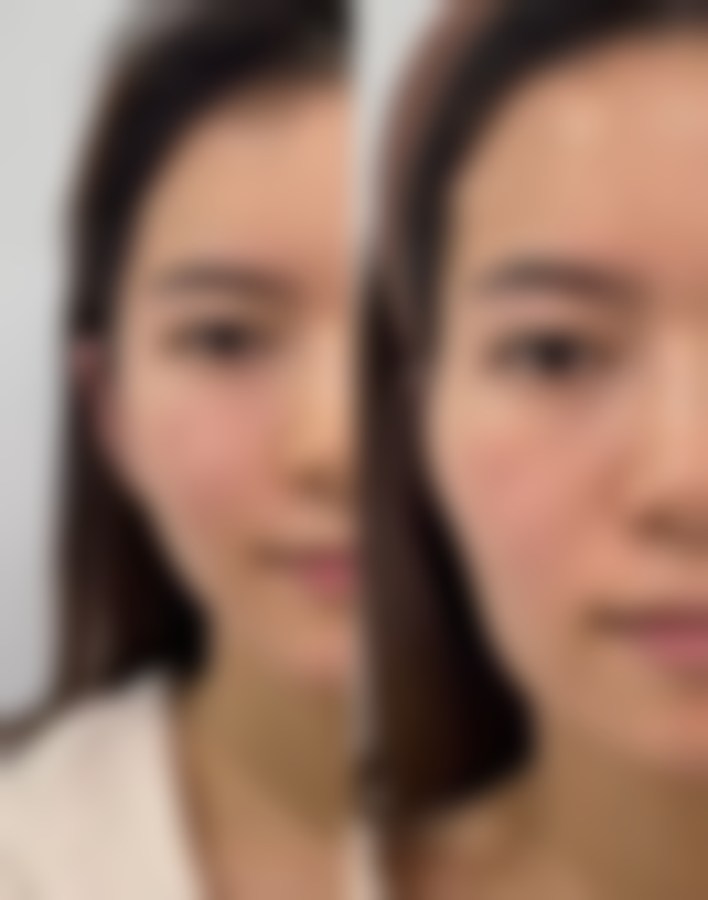 三、不同类型软骨的特点和适用部位