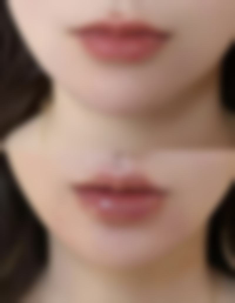 割了双眼皮一个宽一个窄怎么办？分阶段处理+日常护理助你恢复对称美