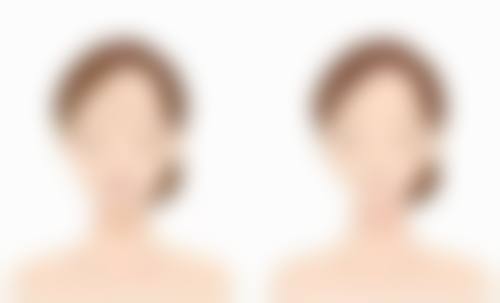 三、具体祛疤膏介绍