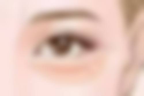 双眼皮手术后祛疤膏哪个比较好用？选对才是关键