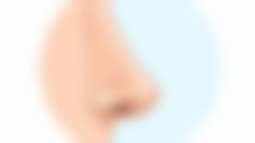 五、应对一个双眼皮一个三眼皮的方法