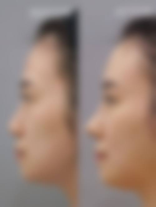 八、河源协和医疗整形美容门诊部真实的患者评价