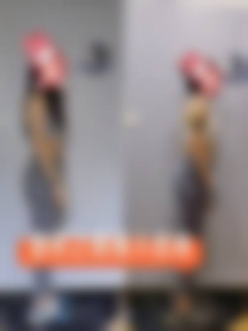 二、深圳卢迦诺医疗美容诊所怎么样？