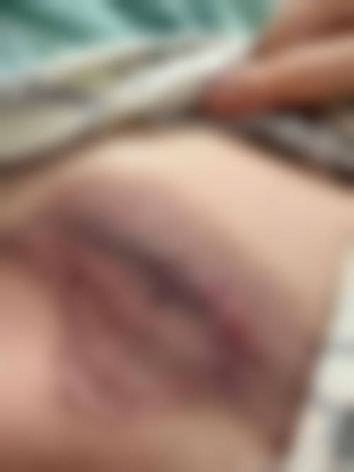 八、哈尔滨名大医疗美容门诊真实的患者评价