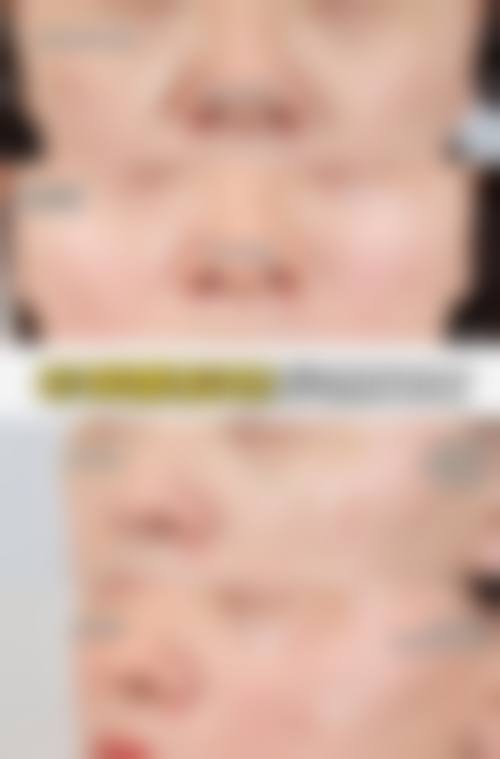 九、深圳卢迦诺医疗美容诊所真实的患者评价