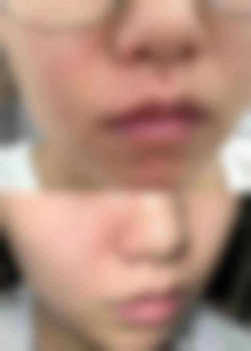 四、河源协和医疗整形美容门诊部特色项目