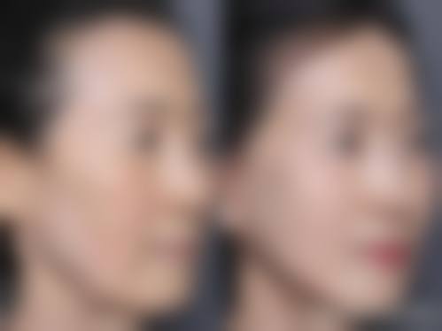 五、运城杨帆医疗美容诊所价格表