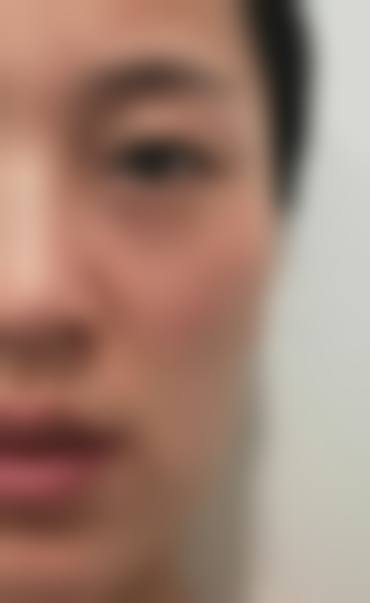 八、广州圣心微美医疗美容门诊部真实的患者评价