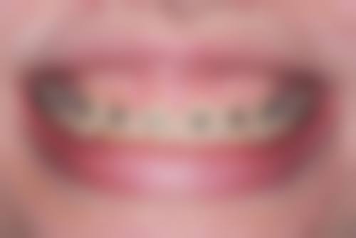 二、亚峰整形美容连锁怎么样？